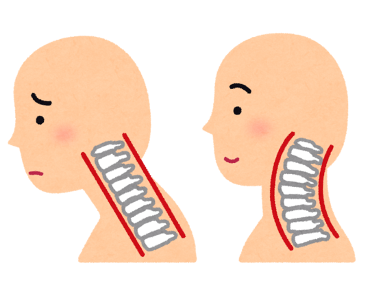 猫背でストレートネックは首後ろのストレッチで解消 長野市の整体院 姿勢 猫背改善 骨盤矯正 カイロプラクティック伊東