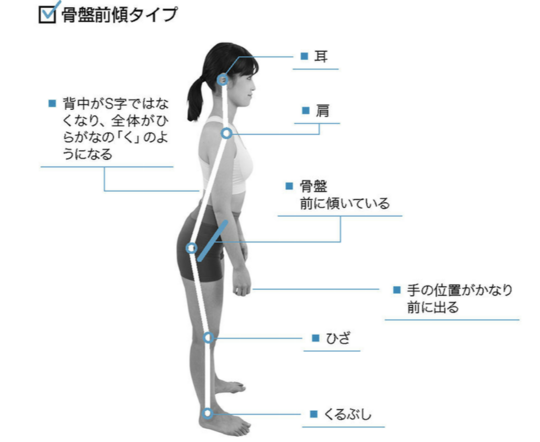 前傾姿勢は骨盤矯正で解消 長野市の整体院 姿勢 猫背改善 骨盤矯正 カイロプラクティック伊東