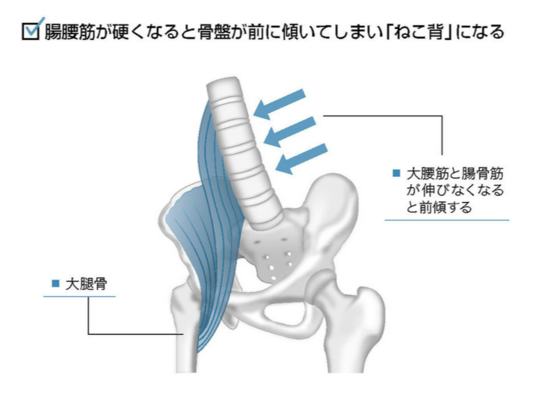 姿勢が悪くてお尻が大きいのは骨盤矯正で解消 長野市の整体院 姿勢 猫背改善 骨盤矯正 カイロプラクティック伊東